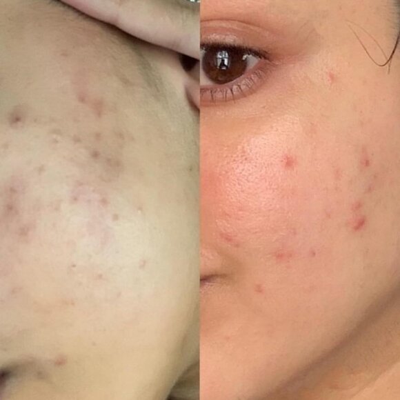 MARA - Sea Vitamin C Serum for Redness Reduction with Algae | Supercharged - Picture 5 of 6